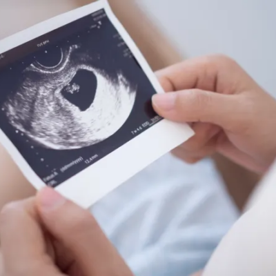 Congreso de Perú aprueba ley que garantiza la protección de la mujer embarazada y su bebé